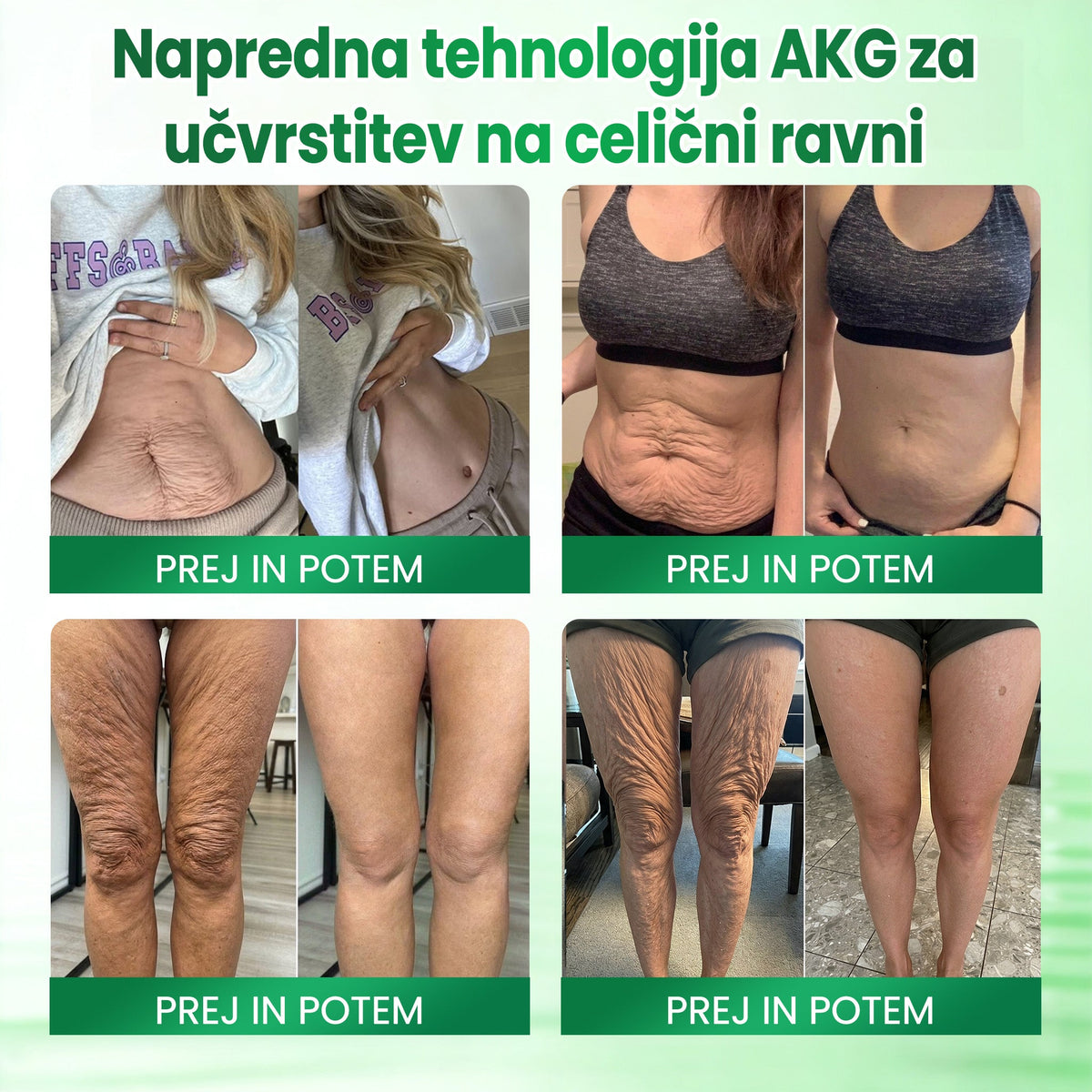 Medistart® AKG – Učvrstitvena nega kože proti znakom staranja