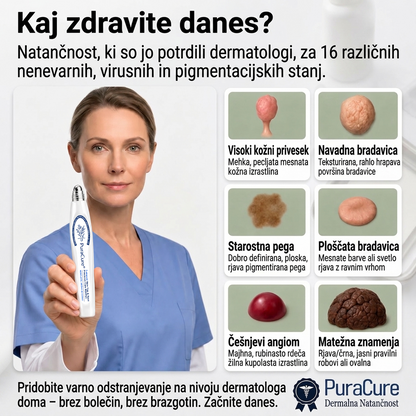 🥇🥇PuraCure®👩‍⚕️ Rezultati so vidni že v 7 dneh! Valjček za odstranjevanje bradavic in drugih kožnih težav | Neboleče in minimalno razmaže.