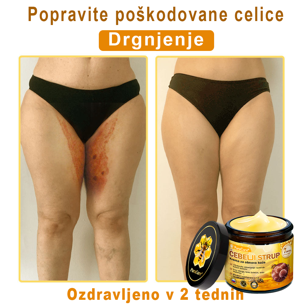 PuraCure® Krema za obnovo kože z čebeljim strupom | 50 ml | Priporočeno češko dermatovenerološko društvo
