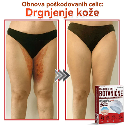 🗽✅PuraCure®Botanični obliž z mikroiglami za odstranjevanje kožnih izrastkov