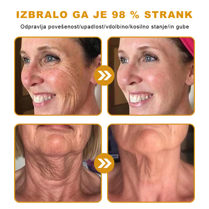 Sinvie® Krema za obnovo kože z čebeljim strupom | 50 ml | Priporočeno češko dermatovenerološko društvo