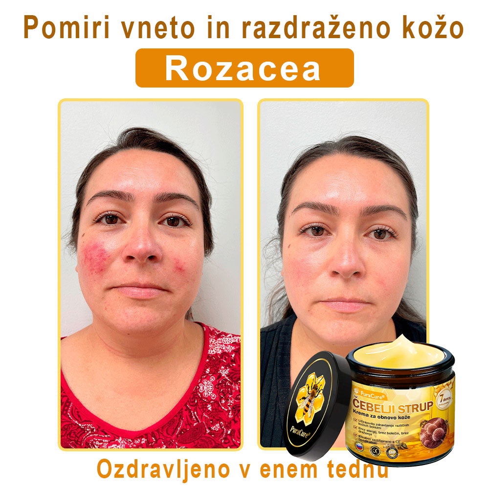 PuraCure® Krema za obnovo kože z čebeljim strupom | 50 ml | Priporočeno češko dermatovenerološko društvo