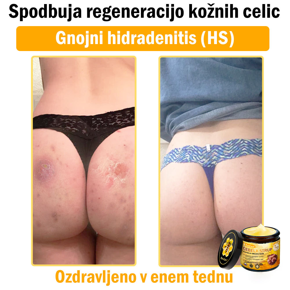 PuraCure® Krema za obnovo kože z čebeljim strupom | 50 ml | Priporočeno češko dermatovenerološko društvo