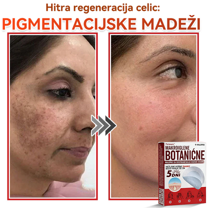 🗽✅PuraCure®Botanični obliž z mikroiglami za odstranjevanje kožnih izrastkov