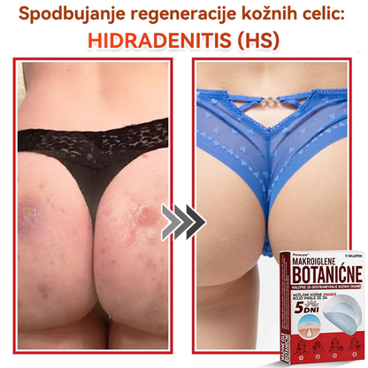 🗽✅PuraCure®Botanični obliž z mikroiglami za odstranjevanje kožnih izrastkov