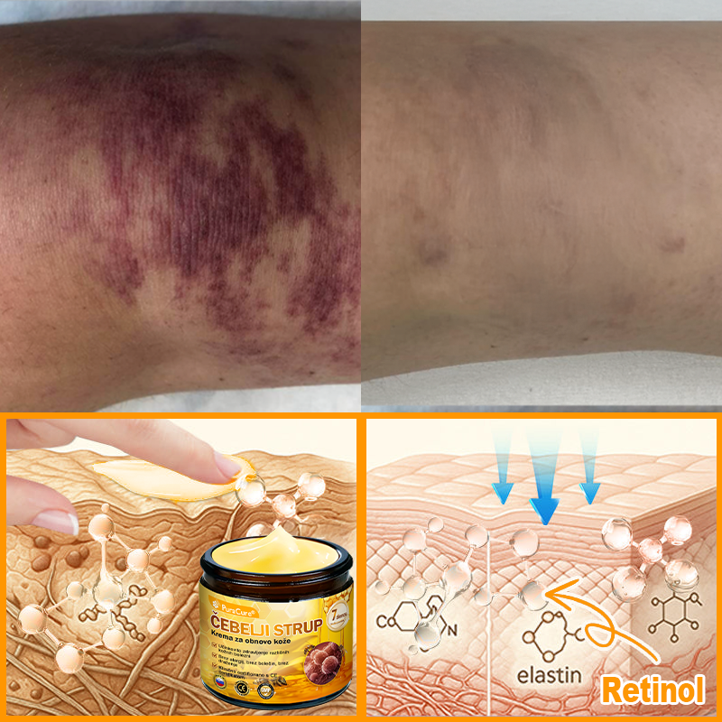 PuraCure® Krema za obnovo kože z čebeljim strupom | 50 ml | Priporočeno češko dermatovenerološko društvo