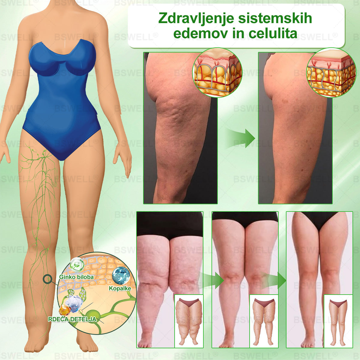 🍀👩‍🔬BSWELL® Nano mikroneedling shujševalni obliž (Samo enkrat na dan, vidne spremembe v 28 dneh)  ✅ Za debelost, zdravje srca in ožilja, sladkorno bolezen, spalno apnejo, zdravje črevesja, težave s sklepi in še več.