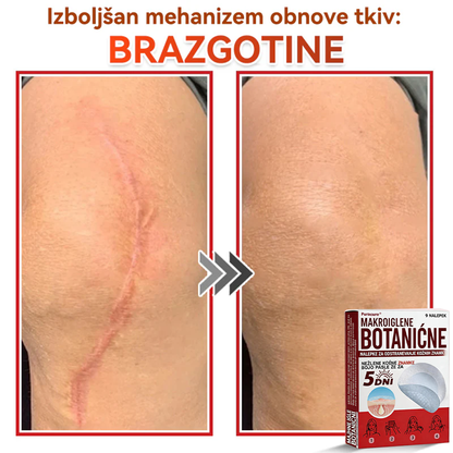 🗽✅PuraCure®Botanični obliž z mikroiglami za odstranjevanje kožnih izrastkov