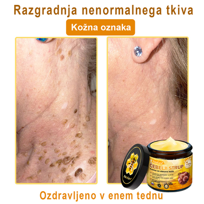 PuraCure® Krema za obnovo kože z čebeljim strupom | 50 ml | Priporočeno češko dermatovenerološko društvo