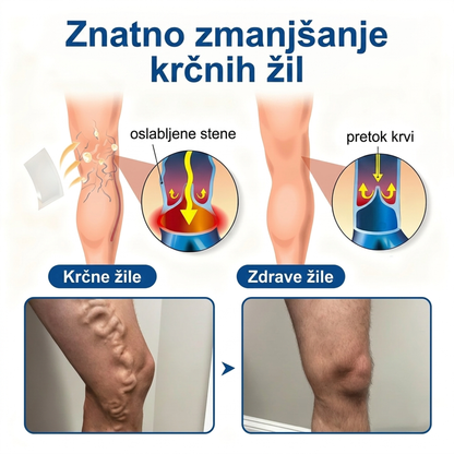 🔥Medistart® Mikroiglični obliž za nego krčnih žil ⚡ Takojšnje olajšanje, dolgotrajni učinki