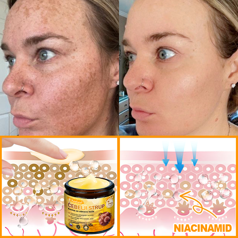 PuraCure® Krema za obnovo kože z čebeljim strupom | 50 ml | Priporočeno češko dermatovenerološko društvo