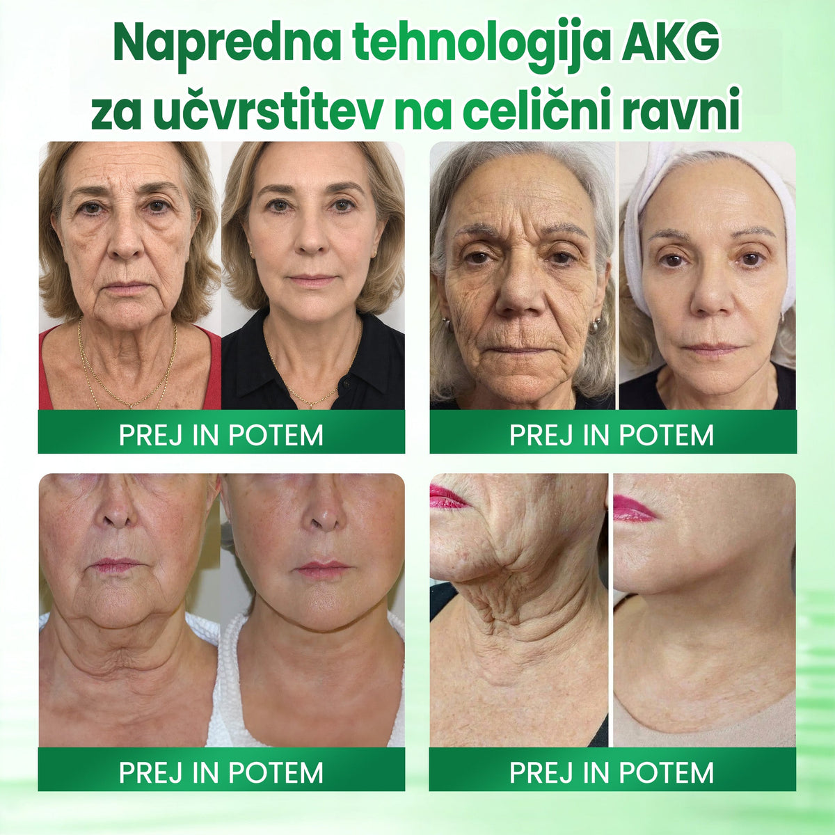 Medistart® AKG – Učvrstitvena nega kože proti znakom staranja