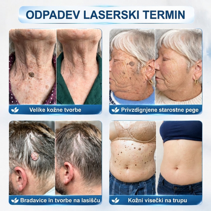 🥇🥇PuraCure®👩‍⚕️ Rezultati so vidni že v 7 dneh! Valjček za odstranjevanje bradavic in drugih kožnih težav | Neboleče in minimalno razmaže.