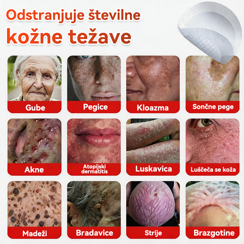 🗽✅PuraCure®Botanični obliž z mikroiglami za odstranjevanje kožnih izrastkov