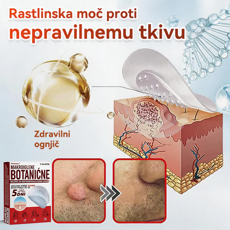🗽✅PuraCure®Botanični obliž z mikroiglami za odstranjevanje kožnih izrastkov