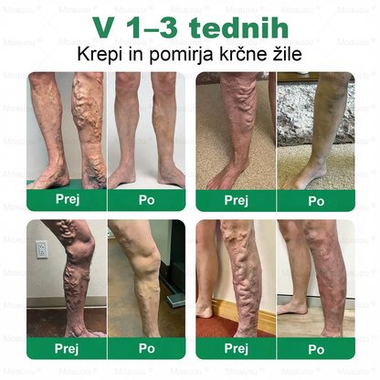👨‍⚕️Moauou® VeinTarget Mikron Needl Patch⚡Takojšnja Olajšava, Dolgoročni Rezultati - Velika Razprodaja