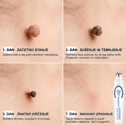 🥇🥇PuraCure®👩‍⚕️ Rezultati so vidni že v 7 dneh! Valjček za odstranjevanje bradavic in drugih kožnih težav | Neboleče in minimalno razmaže.