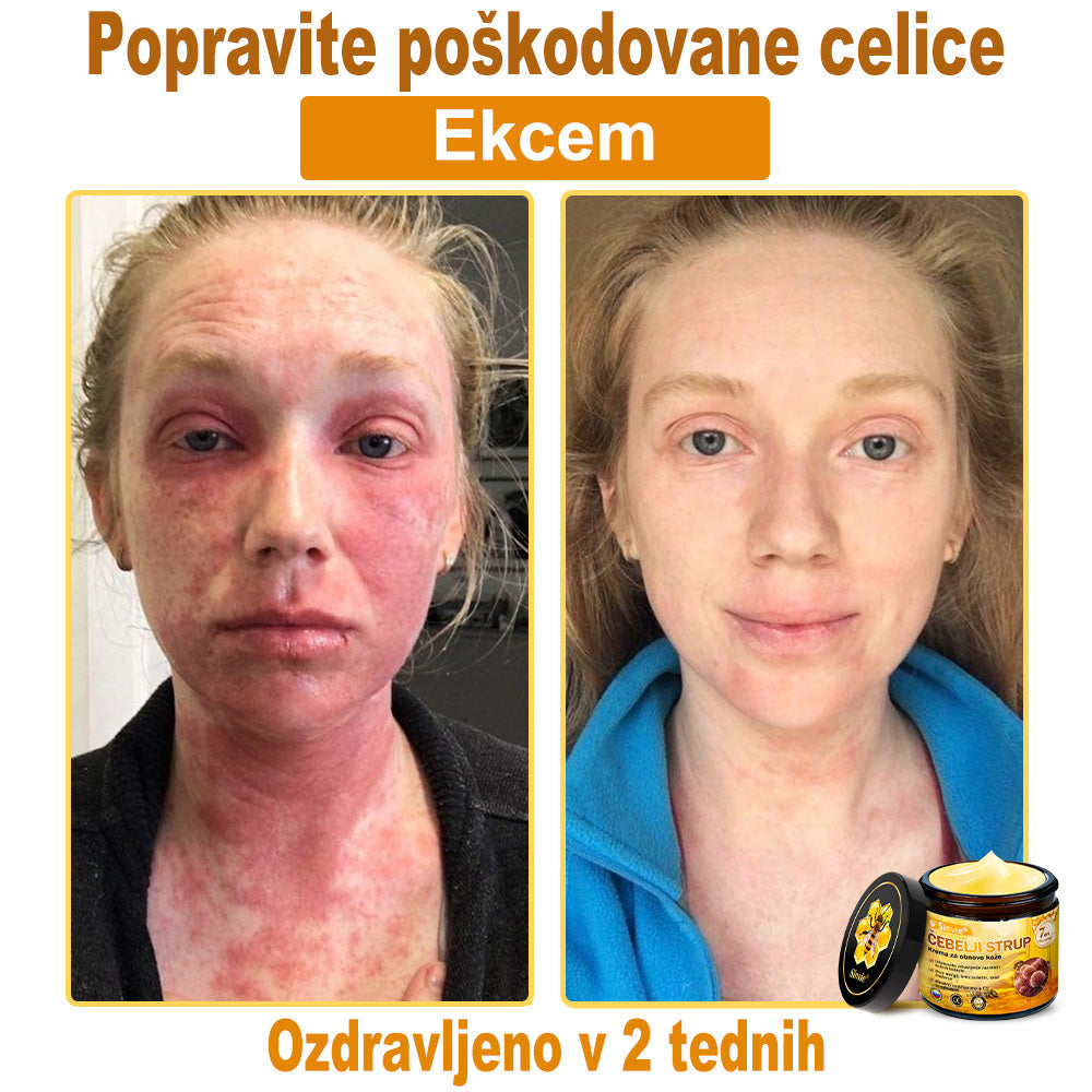 Sinvie® Krema za obnovo kože z čebeljim strupom | 50 ml | Priporočeno češko dermatovenerološko društvo