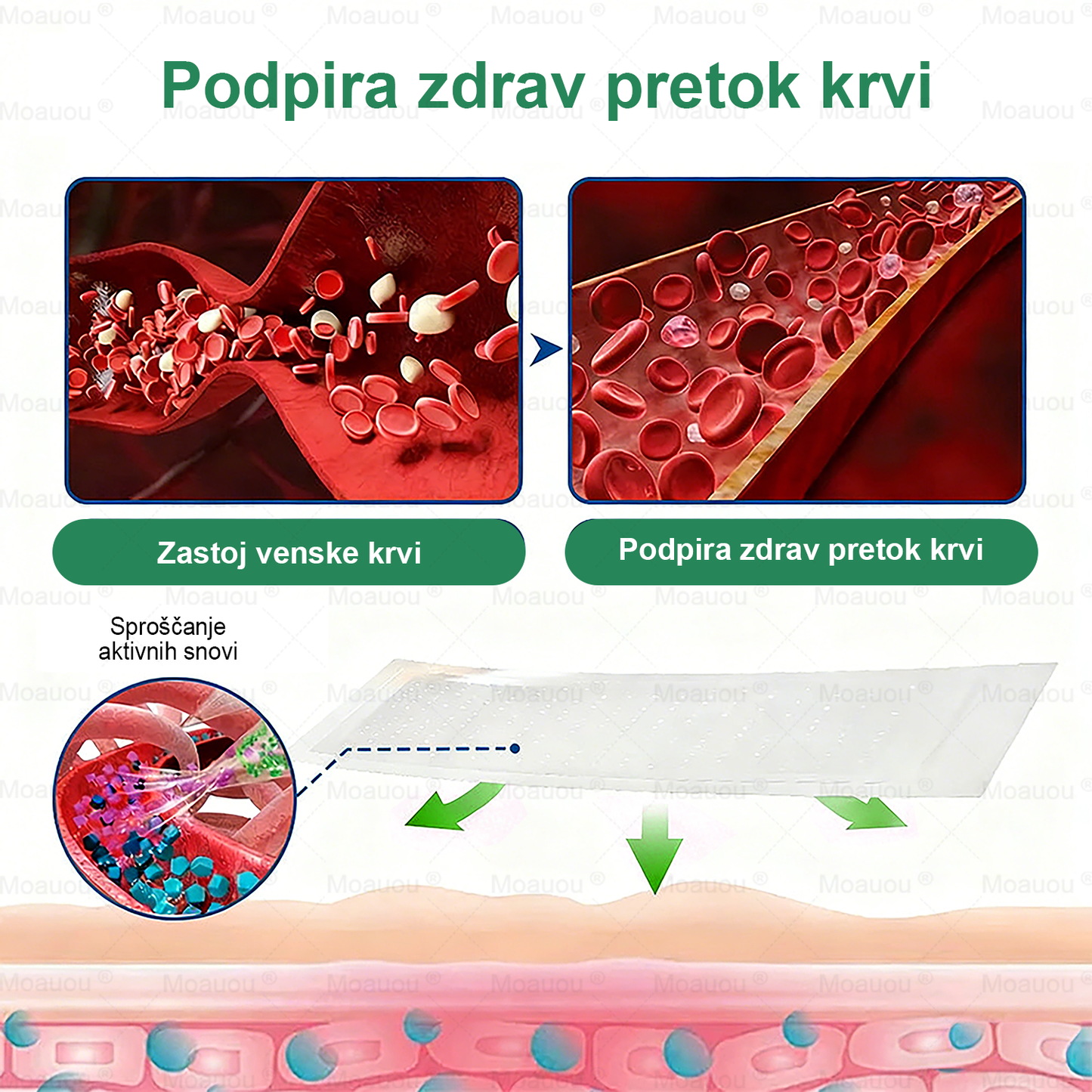 👨‍⚕️Moauou® VeinTarget Mikron Needl Patch⚡Takojšnja Olajšava, Dolgoročni Rezultati - Velika Razprodaja