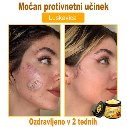 PuraCure® Krema za obnovo kože z čebeljim strupom | 50 ml | Priporočeno češko dermatovenerološko društvo